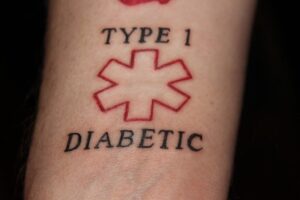 Tatuagens e Diabetes: O que você precisa saber